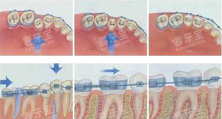 ���ݽ����ƶ�����ʾ��ͼ