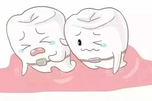 牙齿矫正卡通 牙齿矫正卡通