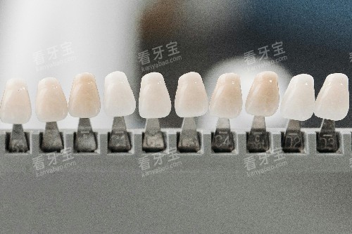 牙齿贴面色号 牙齿贴面色号