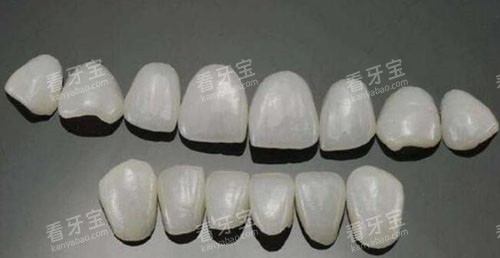 瓷贴面修复改善 瓷贴面修复改善