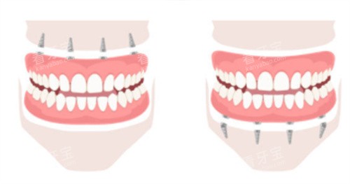 �ϰ����ֲ�����°����ֲ��