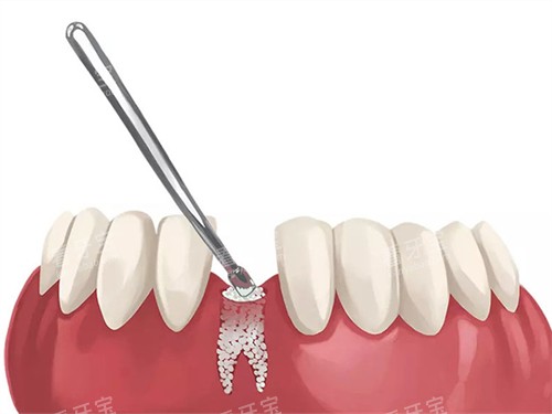 ��ֲ��ֲ�ǵ�����ͼ