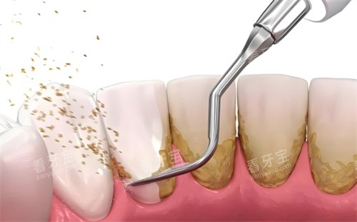 ϴ������չʾ