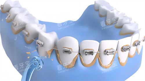 ϴ�����̶���չʾͼƬ